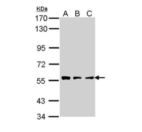 CLN2 antibody from Signalway Antibody (22320) - Antibodies.com