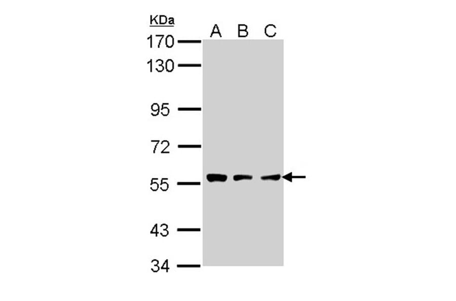 CLN2 antibody from Signalway Antibody (22320) - Antibodies.com