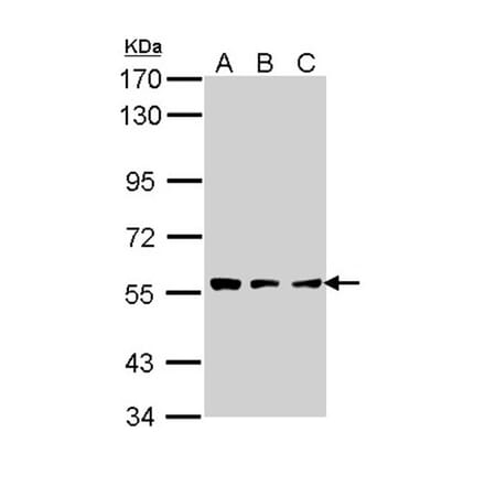 CLN2 antibody from Signalway Antibody (22320) - Antibodies.com