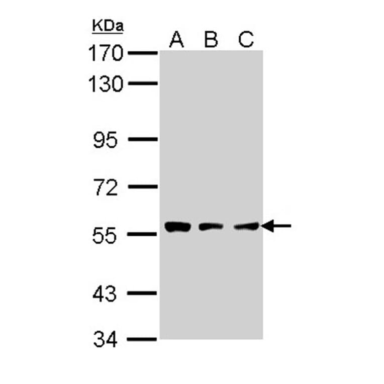 CLN2 antibody from Signalway Antibody (22320) - Antibodies.com