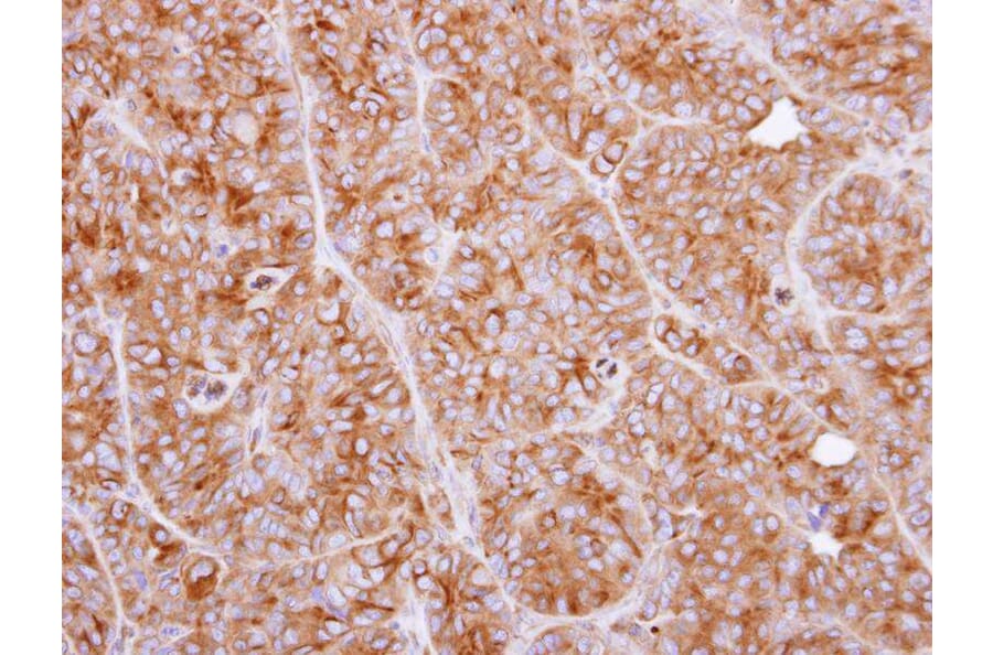 Immunohistochemistry - CLN2 antibody from Signalway Antibody (22320) - Antibodies.com