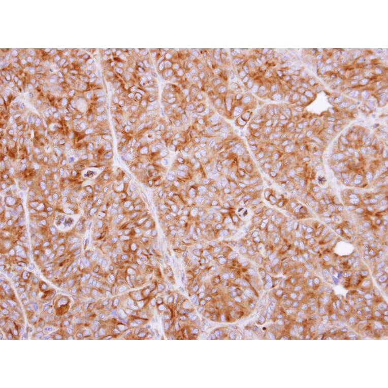 Immunohistochemistry - CLN2 antibody from Signalway Antibody (22320) - Antibodies.com