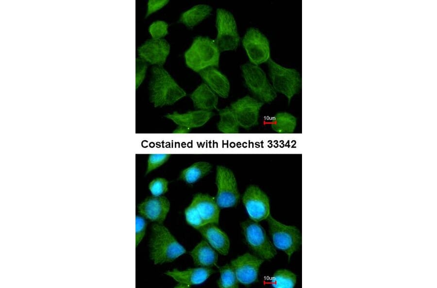 Immunofluorescence - CLN2 antibody from Signalway Antibody (22320) - Antibodies.com