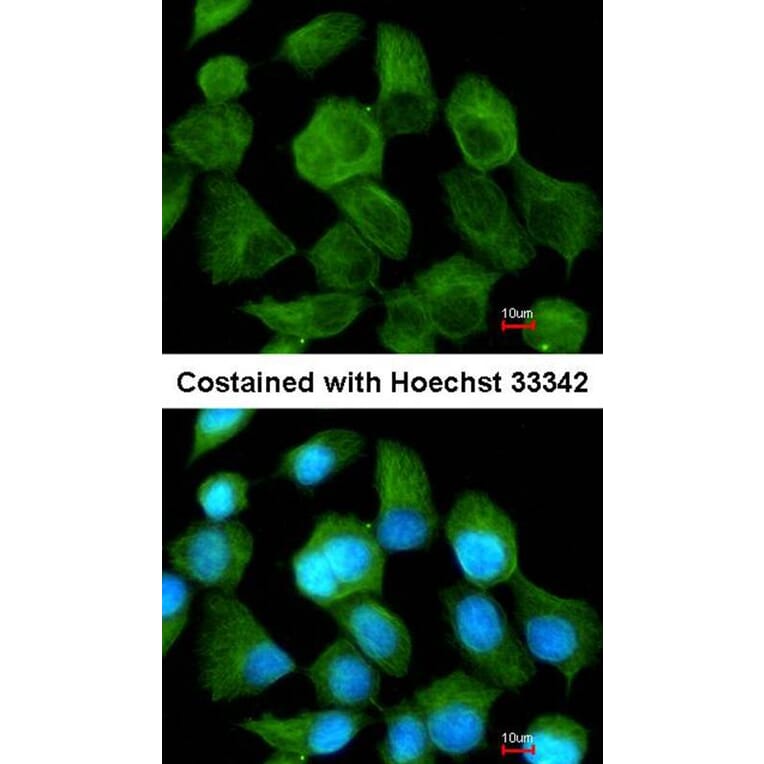 Immunofluorescence - CLN2 antibody from Signalway Antibody (22320) - Antibodies.com