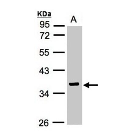 IDH3G antibody from Signalway Antibody (22353) - Antibodies.com