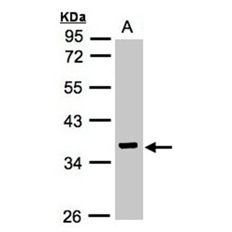 IDH3G antibody from Signalway Antibody (22353) - Antibodies.com