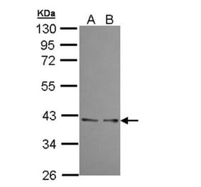UFD1L antibody from Signalway Antibody (22366) - Antibodies.com