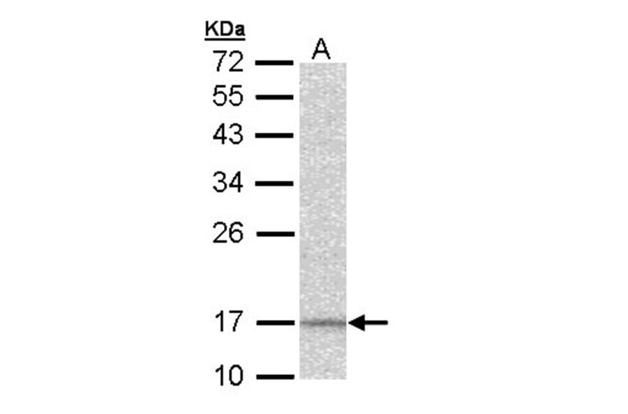 DAP13 antibody from Signalway Antibody (22408) - Antibodies.com