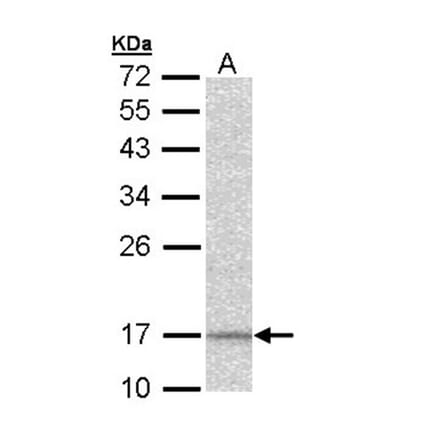 DAP13 antibody from Signalway Antibody (22408) - Antibodies.com