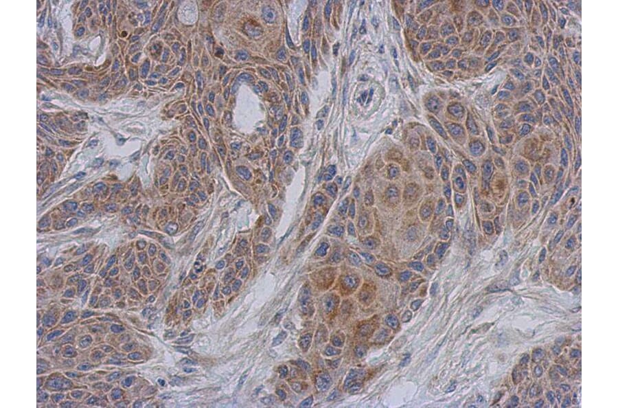 Immunohistochemistry - DAP13 antibody from Signalway Antibody (22408) - Antibodies.com