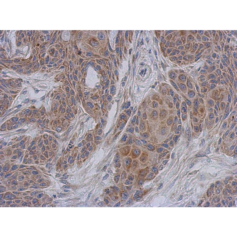 Immunohistochemistry - DAP13 antibody from Signalway Antibody (22408) - Antibodies.com