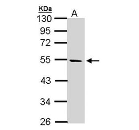 STK25 antibody from Signalway Antibody (22448) - Antibodies.com