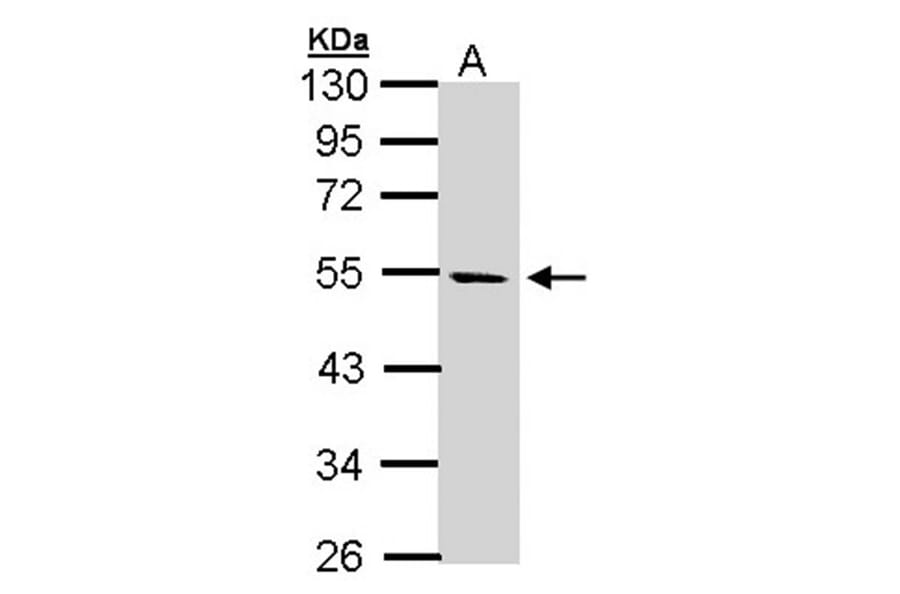 STK25 antibody from Signalway Antibody (22448) - Antibodies.com