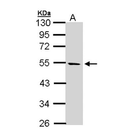 STK25 antibody from Signalway Antibody (22448) - Antibodies.com