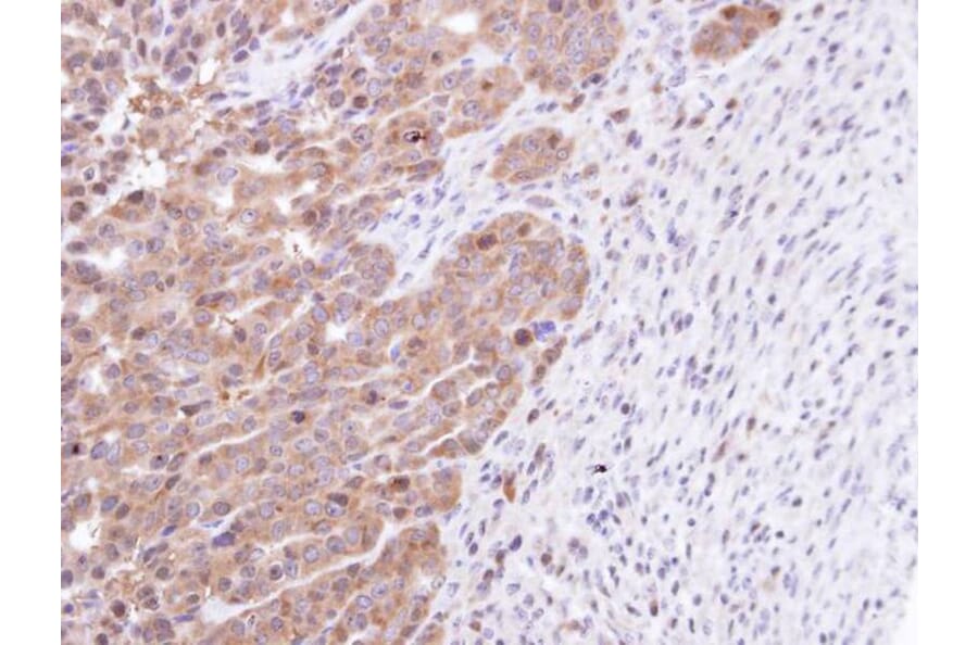 Immunohistochemistry - STK25 antibody from Signalway Antibody (22448) - Antibodies.com