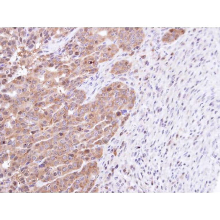 Immunohistochemistry - STK25 antibody from Signalway Antibody (22448) - Antibodies.com