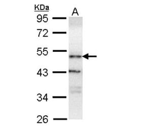 ORP-1 antibody from Signalway Antibody (22467) - Antibodies.com