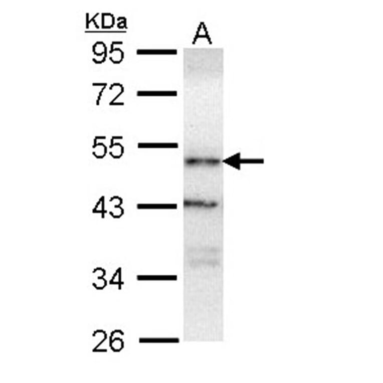 ORP-1 antibody from Signalway Antibody (22467) - Antibodies.com