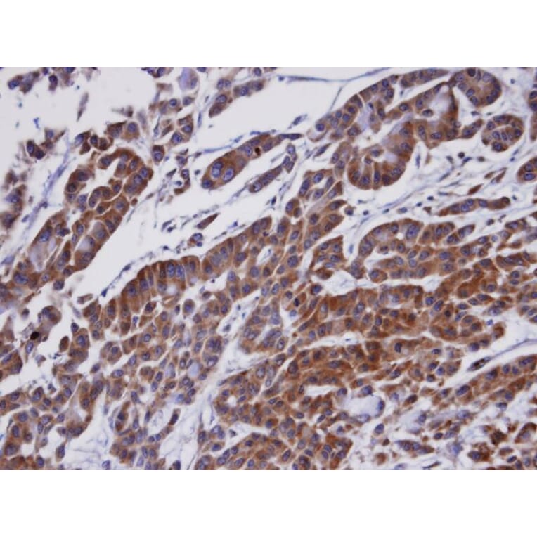 Immunohistochemistry - ORP-1 antibody from Signalway Antibody (22467) - Antibodies.com