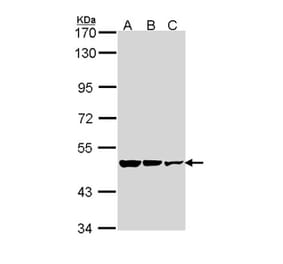 GAD65 antibody from Signalway Antibody (22484) - Antibodies.com