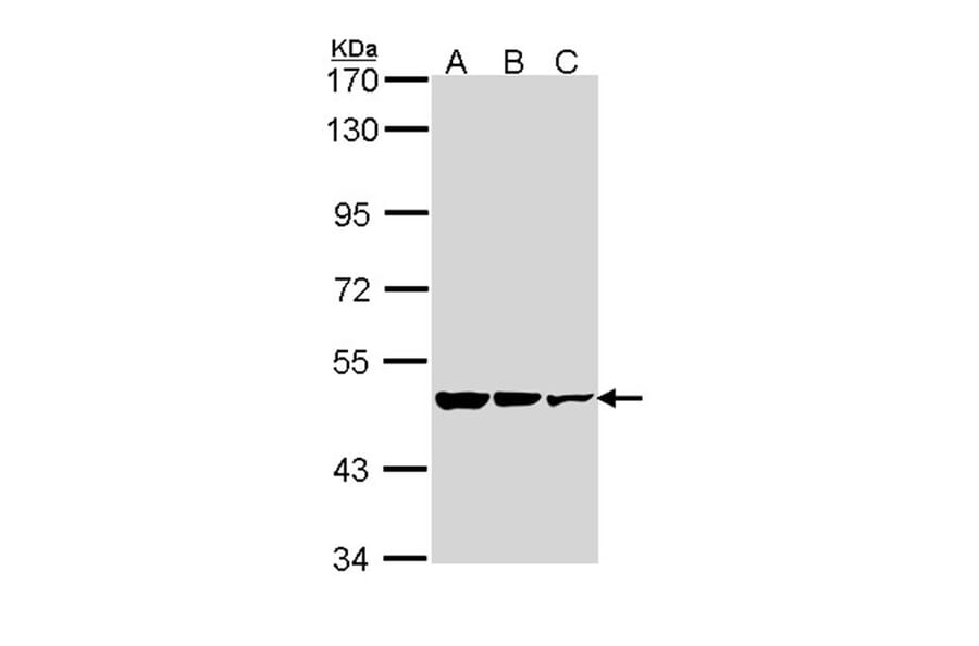 GAD65 antibody from Signalway Antibody (22484) - Antibodies.com