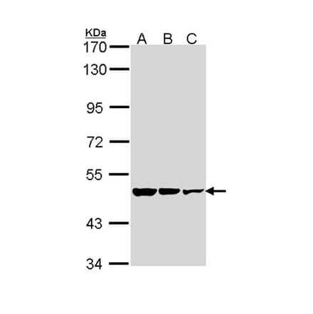 GAD65 antibody from Signalway Antibody (22484) - Antibodies.com