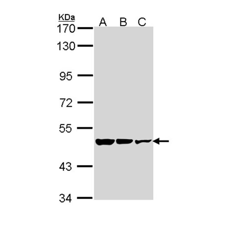 GAD65 antibody from Signalway Antibody (22484) - Antibodies.com