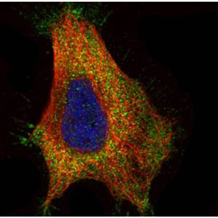 GAD65 antibody from Signalway Antibody (22484) - Antibodies.com