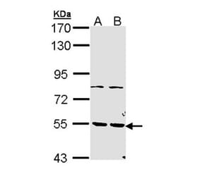 PDE1A antibody from Signalway Antibody (22496) - Antibodies.com