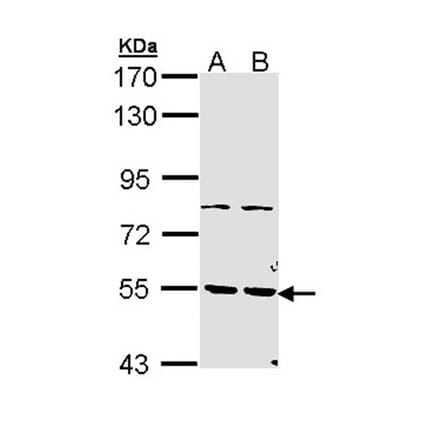 PDE1A antibody from Signalway Antibody (22496) - Antibodies.com
