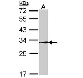NR0B2 antibody from Signalway Antibody (22509) - Antibodies.com