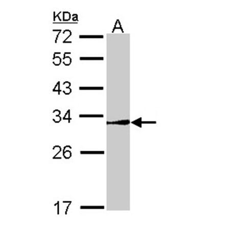 NR0B2 antibody from Signalway Antibody (22509) - Antibodies.com