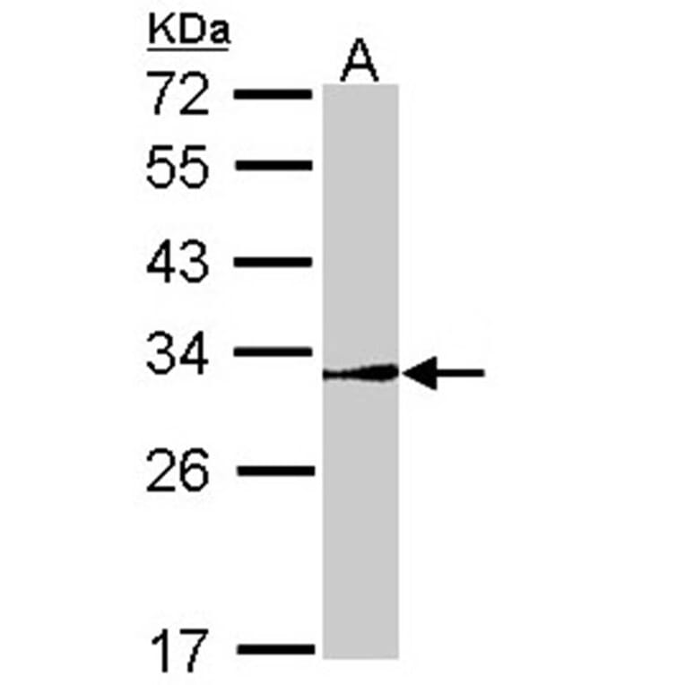 NR0B2 antibody from Signalway Antibody (22509) - Antibodies.com