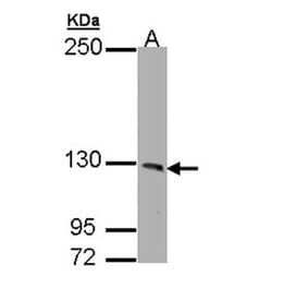 PHKA1 antibody from Signalway Antibody (22521) - Antibodies.com