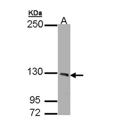 PHKA1 antibody from Signalway Antibody (22521) - Antibodies.com