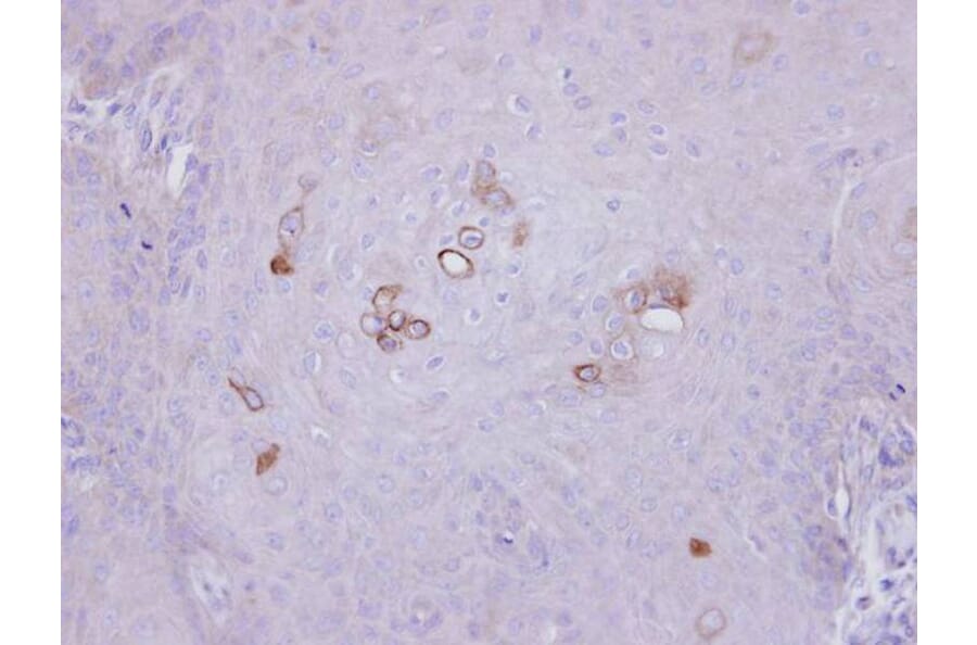 Immunohistochemistry - PHKA1 antibody from Signalway Antibody (22521) - Antibodies.com