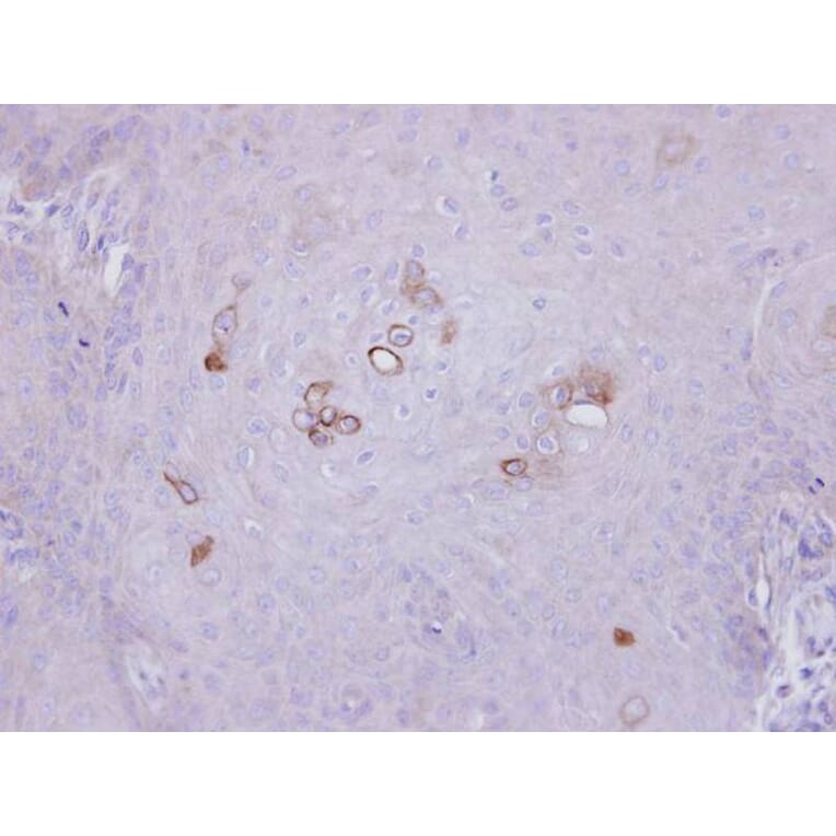 Immunohistochemistry - PHKA1 antibody from Signalway Antibody (22521) - Antibodies.com