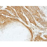 Immunohistochemistry - HSPA6 antibody from Signalway Antibody (22523) - Antibodies.com