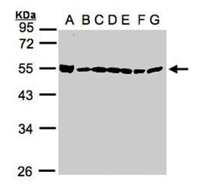 DDX39 antibody from Signalway Antibody (22535) - Antibodies.com