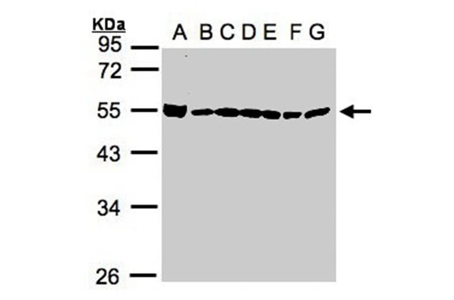 DDX39 antibody from Signalway Antibody (22535) - Antibodies.com