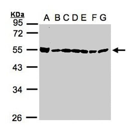 DDX39 antibody from Signalway Antibody (22535) - Antibodies.com