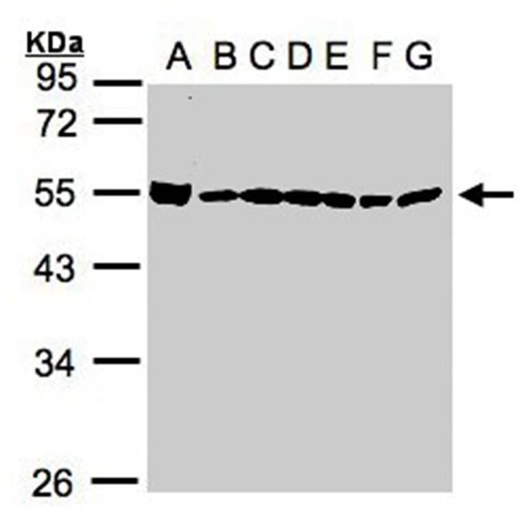DDX39 antibody from Signalway Antibody (22535) - Antibodies.com