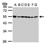 DDX39 antibody from Signalway Antibody (22535) - Antibodies.com
