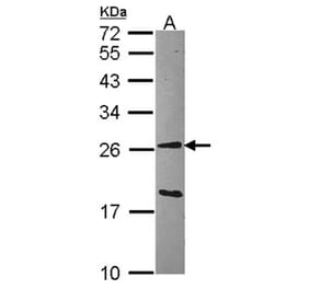 GSTA1 antibody from Signalway Antibody (22536) - Antibodies.com