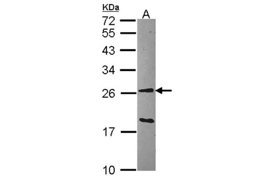 GSTA1 antibody from Signalway Antibody (22536) - Antibodies.com
