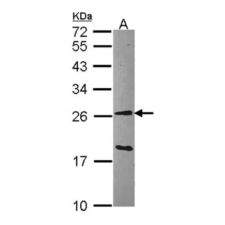 GSTA1 antibody from Signalway Antibody (22536) - Antibodies.com