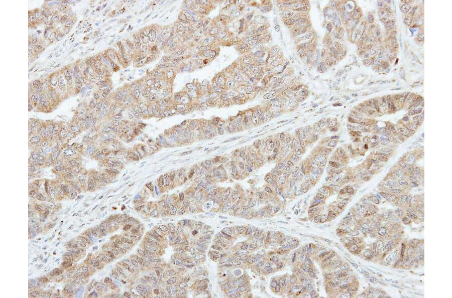 Immunohistochemistry - GSTA1 antibody from Signalway Antibody (22536) - Antibodies.com