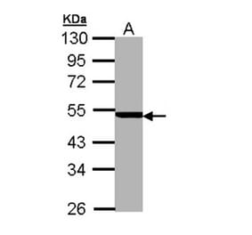 PSMC3 antibody from Signalway Antibody (22558) - Antibodies.com