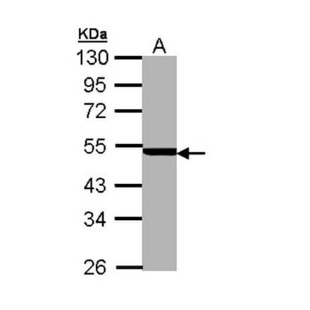 PSMC3 antibody from Signalway Antibody (22558) - Antibodies.com