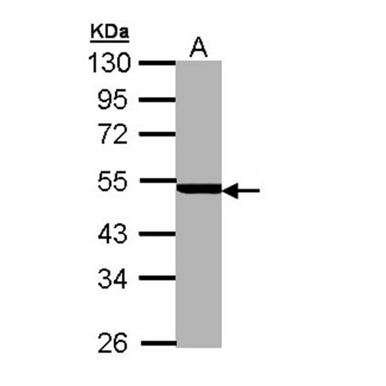 PSMC3 antibody from Signalway Antibody (22558) - Antibodies.com